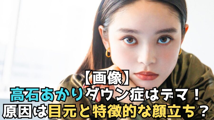 高石あかり　ダウン症　デマ